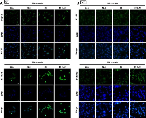 Figure 4 Miconazole promotes NRF2 nuclear translocation in bladder cancer cells. (A and B) T24 and 5637 bladder cancer cells were treated with increased concentrations of miconazole for 24 h, then subjected to immunofluorescence staining by anti-p62 and -NRF2 antibodies. Nuclei were counterstained with DAPI. Representative microscopy images were shown.