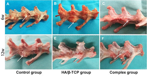 Figure 7 Macroscopic observations of the vertebral body defect healing in the three groups at 6 weeks (A–C) and 12 weeks (D–F) after surgery. The white arrow of picture is pointing to the spine defect area.
