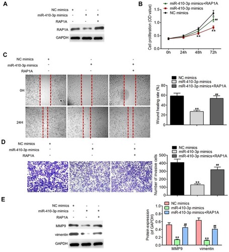Figure 5 Rescue of RAP1A expression reverses the tumor-suppressing effects of miR-410-3p over-expression in glioma cells. (A) RAP1A protein expression was determined by Western blotting analysis after rescue of its expression in miR-410-3p mimics-treated U251MG cells. (B) Cell proliferation was evaluated by MTT assays after rescue of RAP1A expression in miR-410-3p mimics-treated U251MG cells. (C) Migration was assessed by wound healing assays after rescue of RAP1A expression in miR-410-3p mimics-treated U251MG cells. (D) Invasion was determined by transwell invasion assays after rescue of RAP1A expression in miR-410-3p mimics-treated U251MG cells. (E) The expression levels of motility-associated proteins (MMP9 and vimentin) are examined by Western blotting analysis after rescue of RAP1A expression in miR-410-3p mimics-treated U251MG cells. **P<0.01 vs NC mimics group, ##P<0.01 vs miR-410-3p mimics group.Abbreviations: MMP9, matrix metalloproteinase 9; NC, negative control.