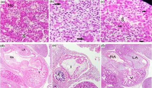 Figure 2. Transverse sections of liver (a–c) and heart (d–f) of 3-days chick embryos: (a) Normal structure of liver of control cases with normal hepatocyte cords Hc and sinusoids S (b) Liver of group 2 showing adverse degree of histopathological modifications: inflammatory infiltrations and rosette of hepatocytes (black arrows) (c) Liver of group 3 showing normal architecture in appearance with hepatocyte cord in line (black arrows)and single hepatocytes (white arrows) (d) Heart of group 1 control case with normal atrial chambers left and right (RA, LA)and thick walled ventricle (V) (e) Heart of group 2 injected with LPS showing malformed atrium an(A) and small and thin walled ventricle.