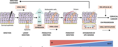 Figure 2. Viral biomarkers during HPV infection and progression to cervical cancer. After HPV infection at the basal membrane in the epithelia (virus detectable on DNA level), the virus will replicate its genome at low copy numbers, maintaining a latent infection in the basal keratinocytes. Next, the infection will switch to a productive infection where the virus expresses its genome, while keratinocytes differentiate, forming koilocytotic cells (E4+) and finally resulting in the release of the virus in the upper layers of the epithelia, enabling viral load assessment. After viral release, virions can re-infect the basal membrane leading to a persistent infection. Persistent infections present a higher risk of undergoing HPV genome integration to the host genome in the epithelia, resulting in cervical intraepithelial neoplasia (CIN) and the progression of these lesions cause cervical cancer. Nevertheless, the lesions can also regress thanks to the response of the host immune system that generates infection clearance. Approximately, in 70% of the cases, hrHPV16 and 18 genotypes are the causative agents of the progression to cervical cancer, which makes viral genotyping an essential biomarker. Besides, the progression of HPV infection to cervical cancer is highly related to the viral oncoproteins E4 and E6/E7; therefore, the analysis of their protein and transcriptional levels, respectively, is important as a biomarker testing for the disease. This infection progression is also associated with the HPV DNA methylation patterns that are higher in later stages of the lesions and cervical cancer