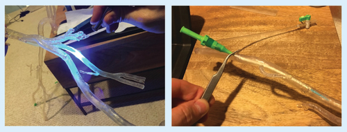 Figure 4. Printed material was separated from the printer base and support scaffolding peeled off.Parts were washed in isopropyl alcohol solution to remove uncured resin from the model surface. The components were fused by painting liquid resin onto the joints, and curing with a handheld UV laser (A). The model was filled with water and vascular access sheaths were secured (B).