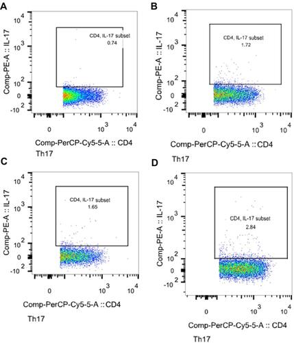 Figure 1 Representative flow cytometric dot-plots of peripheral blood Th17 cells in the each group of subjects. (A) is Healthy control; (B) is COPD patient; (C) is T2DM patient; (D) is COPD+T2DM patient. The percentage of positive cells is shown in each panel.