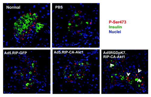 Figure 9. Endogenous Akt activation in pancreatic islets of diabetic mice that were treated with different vectors via intravenous injection. Two weeks after intravenous injection, the mice were sacrificed, and their pancreas were sectioned and processed for immunofluorescence staining using anti-insulin (green) and anti-P-Ser473 (red) antibodies. Note: phosphorylated Akt (P-Ser473) was detected in non-β-cells in normal mice, but appeared in β-cells following Ad5RGDpK7.RIP-CA-Akt1 treated diabetic mice (arrows).