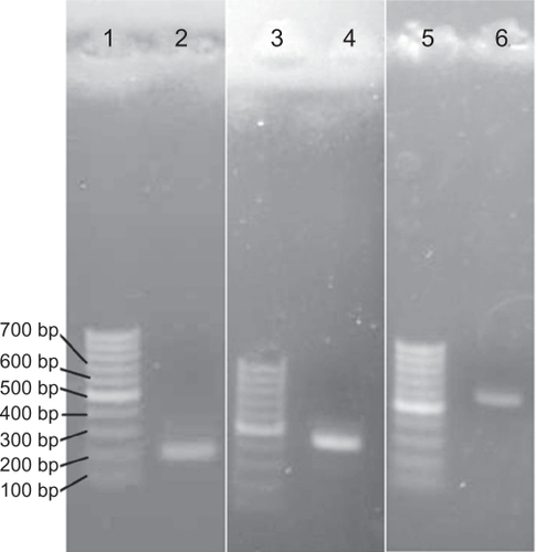 Figure 2 Replacement of glutamic acid codon with cysteine codon using sitedirected mutagenesis. Lanes 1, 3, and 5: 100 bp markers (Fermentas, Lithuania); lane 2: first fragment of mutated cDNA containing kozak sequence and replaced cysteine codon (∼200 bp); lane 4: second fragment of mutated cDNA containing His-tag and replaced cysteine codon (∼400 bp); and lane 6: the complete cDNA of E31C analog (∼600 bp).