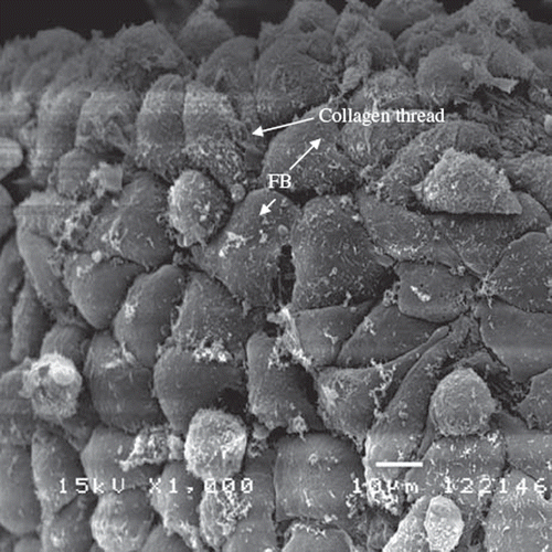 Figure 6. SEM photographs of L929 fibroblasts grown and attached on the glutaraldehyde-crosslinked fibers (7 days after seeding) under 1000× magnification. The cell exhibits a typical spindle-shape on the surface of the fiber. The initial cells’ density is about 2×104 and seeded on the 10 mg glutaraldehyde-crosslinked collagen fibers.
