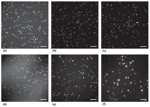 Figure 3 Fluorescence microscope images of astrocyte adhesion after 4 h. Astrocytes were seeded at a density of 5000 cells/cm2 on each sample for 4 h. Cells seeded on glass (a), 100:0 (PU:ZnO) wt.% (b), 98:2 (PU:ZnO) wt.% (c), 90:10 (PU:ZnO) wt.% (d), 75:25 (PU:ZnO) wt.% (e), and 50:50 (PU:ZnO) wt.% (f).Notes: Samples were stained with Calcein-AM prior to imaging. Scale bar = 200 μm.