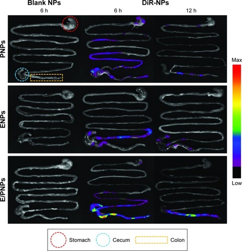 Figure 3 Representative ex vivo images of the GIT after oral administration of blank and DiR-loaded NPs, showing colon-targeted drug delivery and accumulation potential of PNPs, ENPs, and E/PNPs.Abbreviations: GIT, gastrointestinal tract; NPs, nanoparticles; DiR, 1,1′-dioctadecyl-3,3,3′,3′-tetramethylindotricarbocyanine iodide; PNPs, poly(lactic-co-glycolic acid) (PLGA) nanoparticles; ENPs, Eudragit FS30D nanoparticles; E/PNPs, Eudragit FS30D/PLGA nanoparticles.