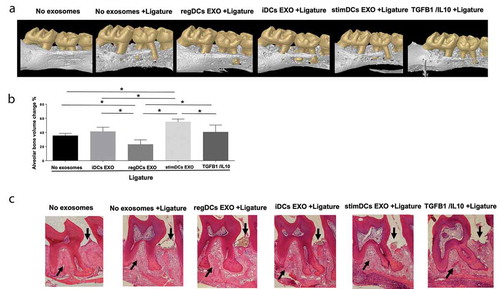 Figure 10. RegDCs EXO inhibit, stimDC EXO promote inflammatory bone loss. (A) Representative microCT generated 3-D images of upper right maxilla with teeth. (B) Bar graphs of alveolar bone volume change % based on quantification of the whole 3-D alveolar bone volume around upper second molar (ligature placement site) by micro CT and normalization to the measurement obtained from the contralateral side (no ligature) which served as baseline, followed by normalization to the alveolar bone volume around the upper right second molar of group that did not receive ligature or exosomes (N=5 in each group; * P<0.05 by one-way ANOVA followed by Tukeys multiple-comparisons). (C) Histological sections showing distinct levels of alveolar bone in furcation area and interdental bone (arrows) of upper right second molar of tested groups.