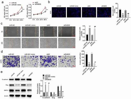 Figure 5. miR-661 acted as a tumor suppressor and RAB3D was an oncogene in melanoma (a) CCK-8 assay implied that miR-661 suppressed the viability of melanoma cells and RAB3D had the opposite function. (b) EdU experiment indicated that miR-661 inhibited the proliferation ability of melanoma cells and RAB3D showed the opposite function. (c) Wound healing assay revealed that miR-661 possessed inhibitory effect on the migration ability of melanoma cells and RAB3D exhibited the opposite function. (d) Transwell experiment suggested that miR-661 could inhibit the invasion capacity of melanoma cells and RAB3D presented the opposite function. (e) Western blot indicated that miR-661 attenuated the EMT in melanoma cells and RAB3D possessed the opposite function. ** P < 0.01 compared with miR-NC group. ** P < 0.01 compared with siNC group.