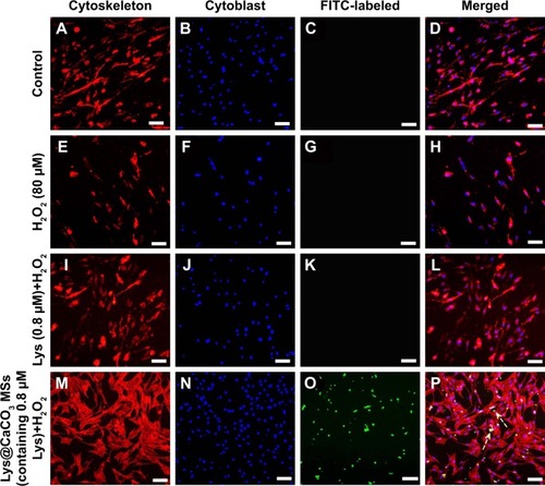 Figure 6 Confocal laser scanning microscopy (CLSM) images show the cell density of osteoblasts cultured under different conditions.Notes: At pH = 5.5: (A–D) control group, without H2O2; (E–H) with 80 μM H2O2; (I–L) with 80 μM H2O2, 0.8 μM Lys; and (M–P) with 80 μM H2O2, Lys@CaCO3 MSs (containing 0.8 μM Lys). The scale bars are 100 μm.Abbreviations: Lys, L-lysine; MSs, microspheres.