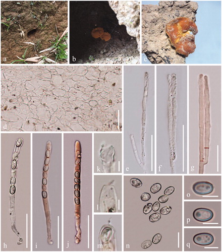 Figure 5. Acervus stipitatus (HKAS 107302). (a) Habitat. (b, c) Typic mature specimens. (d) Receptacle surface of pileus. (e–g) Paraphyses (g Paraphyses in Congo red.). (h–j) Asci (i-i Asci in Congo red.). (k–m) Apexes of asci. (n–q) Ascospores. Scale bars: d, h–j = 30 μm. e–g = 20 μm. k–m, o–q = 5 μm. n = 15 μm.