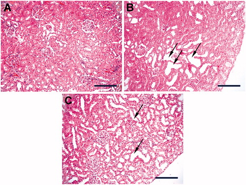 Figure 1. Light microscopic examination of the kidneys. (A) Shows the kidney of control group. (B) There was mild to moderate glomerular congestion, and severe tubular dilatation and injury (arrows) in ESW group. (C) Tubular structures were preserved in the kidneys of ESW + 3-AB groups compared with the ESW group (H & E, Scale bars; 150 µm).