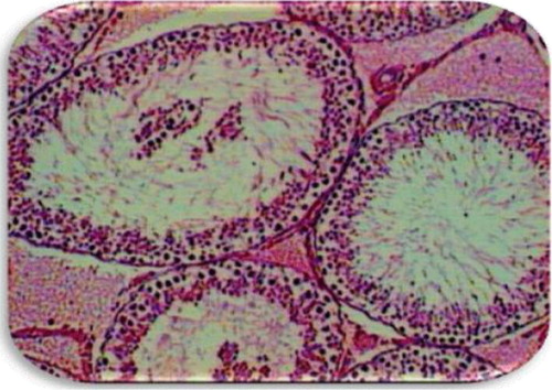 Fig. 5 Epididymis of genetically modified soya-bean-fed rats showing immature sperm and degenerated seminal products.