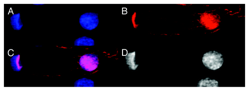Figure 5. Images of dsDNA (DAPI, blue) and dsRNA/DNA (TRITC-Ab, red) stain in mononuclear metakaryotic cell undergoing asymmetrical amitosis in a colonic adenocarcinoma (M, 68 y). (A) DAPI fluorescence (blue). (B) TRITC-Ab fluorescence (red). (C) Merged images of (AandB) showing nuclei labeled simultaneously with DAPI and TRITC-Ab. (D) Achromatic image of (A). Image is interpreted as an asymmetrical amitosis in which both parent bell shaped nucleus and daughter spherical nucleus have reconverted a large fraction of the dsRNA/DNA intermediate (red) to the dsDNA form (blue). Appearance of red fragments or striations of dsRNA/DNA antibody labeling in cytoplasmic volume between nuclei is occasionally observed as shown here in tumors and in the HT-29 cell line. Image by Koledova VV.