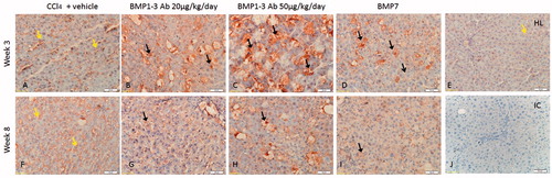 Figure 8. Immunolocalization of decorin in the liver after three and eight weeks of therapy with low (20 µg/kg/day) and high dose (50 µg/kg/day) of BMP1-3 antibody and BMP7 in rats with induced LF. After three weeks of therapy in all treatment groups, the intensity of cytoplasmic decorin staining increased in hepatocytes. (A) Liver three weeks after induction of fibrosis; (B) BMP1-3Ab low dose after three weeks; (C) BMP1-3Ab high dose after three weeks; (D) BMP 7 after three weeks; (E) Healthy rat liver; (F) Liver eight weeks after induction of fibrosis; (G) BMP1-3Ab low dose after eight weeks; (H) BMP1-3Ab high dose after eight weeks; (I) BMP7 after eight weeks; and (J) non-immune IgG of the same isotype (IC) in concentration as the primary monoclonal antibody was used as a negative control. Dark arrows indicate decorin cytoplasmic staining in hepatocytes and arrowheads indicate decorin in SEC (magnification ×40). Scale bar length is 50 µm.