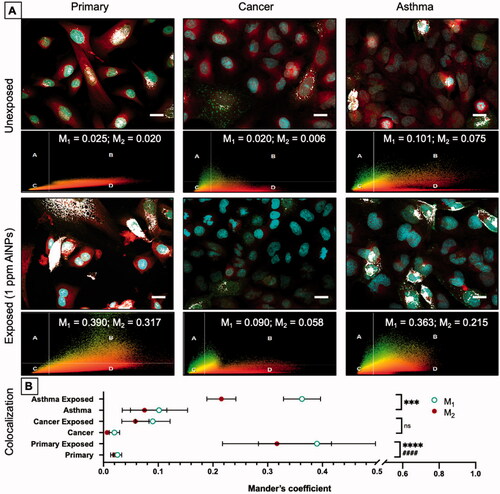 Figure 6. Colocalization of lysosomes and mitochondria. Fluorescent images of primary, cancer, and asthma cells before and after exposure to AlNPs (1 ppm; 1.6 × 1 0 −7 µg/cell) were captured to compare the overlap of the mitochondrial and lysosomal dyes. Scatterplot data from colocalization analysis as well as M1 and M2 values are also shown (A). The blue dye (Hoechst 33342) stains the nucleus, the red dye (MitoTracker Red CM-H2Xros) accumulates in mitochondria, and the green dye (CellLight Lysosomes-GFP) is transduced into the cell and targets lysosomal associated membrane protein 1 (LAMP1). The bright white color represents the areas in the cell where the green (lysosomes) and red (mitochondria) dye colocalize in the cell above the set threshold. These overlap coefficients before and after exposure are visualized in the graph (B). Before exposure small amount of colocalization occur in each cell type with the asthma cells having a small amount of colocalization before exposure. After exposure colocalization increases in the primary and asthma cells while cancer cells do not experience a significant increase. Scale bar = 20 µm.