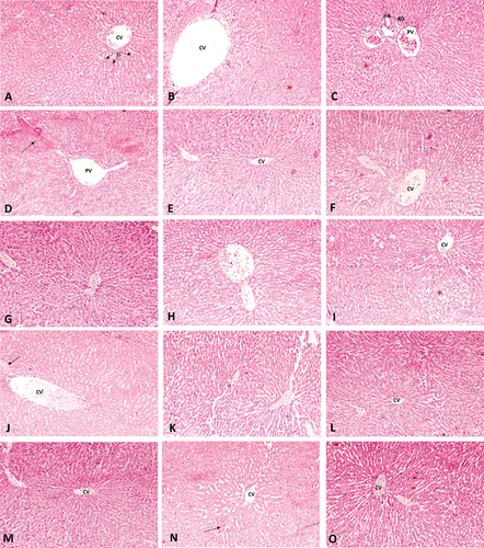 Figure 6. Representative images of A) histology of control rat group liver tissue; (B-D) liver tissue of the lead-treated rat group showing an extremely dilated central vein, bile duct proliferation, and congested portal space; therapeutic group: (E) NCDC-400 (F) NCDC-610; intervention group: (G) NCDC-400 (H) NCDC-610; (I-K) liver tissue of the cadmium-treated rat group showing necrotic hepatocytes, dilated and congested central veins and dilated sinusoidal spaces; therapeutic group: (L) NCDC-410 (M) NCDC-610; intervention group: (N) NCDC-410 (O) NCDC-610. CV: central vein; PV: portal vein; BD: bile duct; SS: sinusoidal spaces. The arrow marks the congested areas. The necrotic areas and areas with ballooning degeneration are denoted by (*).
