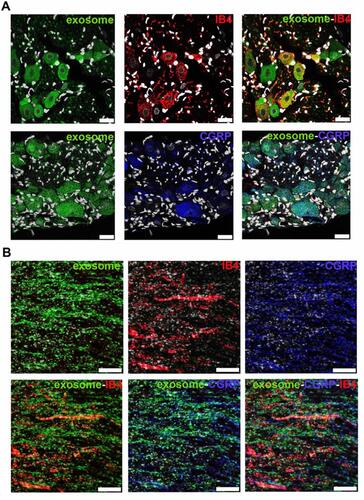 Figure 4 Human umbilical cord mesenchymal stem cell exosomes localize within nociceptors in ipsilateral L5 dorsal root ganglion and L5 axons on day 3 after L5/6 spinal nerve ligation and exosome-scaffold implantation. (A) Representative immunofluorescent image revealing Exo-green-labelled exosomes (green) localized within IB4+ (red) and CGRP+ (blue) nociceptors in ipsilateral L5 dorsal root ganglion. The white spots are DAPI nuclear staining. Scale bar: 25 μm. (B) Representative immunofluorescent image revealing Exo-green-labelled exosomes (green) localized within IB4+ (red) and CGRP+ (blue) nociceptors in injured L5 axons. Scale bar: 100 μm.