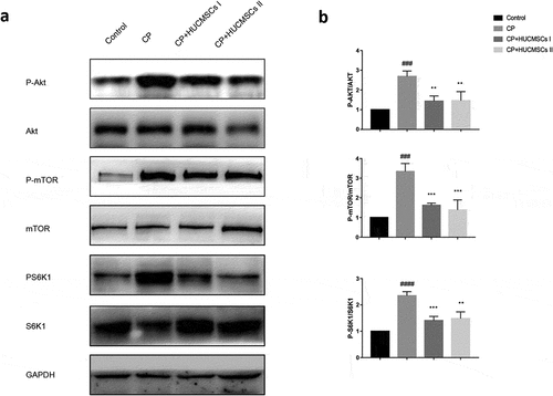 Figure 6. HUCMSCs improve DBTC induced CP by inhibiting AKT-mTOR-S6K1 pathway. Western blot analysis was used to detect the protein expression levels of (a-b) p-AKT, AKT, p-mTOR, mTOR, p-S6k1, and S6K1 . #P < 0.05 versus the control group; *P < 0.05 versus the DBTC-induced chronic pancreatitis modelgroup