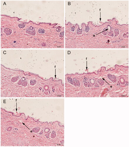 Figure 5. Histological sections of rabbit skin after treatment with or without enhancers. (A): control, (B): d-4-TER, (C): l-4-TER, (D): d-4-T-dC18 and (E): l-4-T-dC18. All tissue sections are magnified 100× (H&E). a, appendageal dilatation; e, edema; and f, focal disruption of epidermis, hyperkeratosis.
