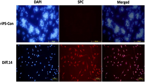 Figure 3. Immunofluorescence staining images for SPC. Nuclei was stained with DAPI in blue color (left). Cytoplasm was stained with SPC in red color (middle). After merging the two images, the two colors displayed in one image (right). Cells in the Diff. 14 group positively expressed SSEA-1 (middle, down), which do not observed in the cells from the riPS-con group (middle, up). 750 × 383 mm (300 × 300 DPI). Diff. 14 group: scale bar, 200 μm. riPS-con group: scale bar, 50 μm.