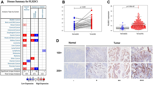 Figure 1 Expression of PLXDC1 in tumors. (A) The expression of PLXDC1 in pan-cancer in the Oncomine database. Figures represent the number of studies. Red represents high expression. Blue represents low expression. (B) Paired difference analysis and (C) unpaired difference analysis of PLXDC1 expression in tumor tissues and paraneoplastic tissues in TCGA database. (D) Immunohistochemical staining analysis of PLXDC1 expression in gastric cancer. -: No staining in normal paracancerous tissue; +: Weak staining in tumor tissues; ++: Moderate staining in tumor tissues; +++: Strong staining in tumor tissues.