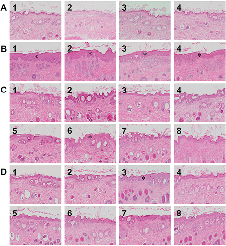 Figure 4 Histological features of the Guinea pig model after dual-diode laser treatment. (A) Uninfected laser-treated controls, (B) infected laser-untreated controls, (C) infected group A after the dual-diode laser treatment, (D) infected group B after the other dual-diode laser treatment. The skin specimens obtained from each infected Guinea pig without dual-diode laser treatment exhibited spongiotic psoriasiform epidermis with parakeratotic stratum corneum (B1–4; asterisks). The skin samples from one Guinea pig in infected group A and one in infected group B presented notably thickened epidermis with parakeratosis (C6 and D3; asterisks): hematoxylin and eosin staining, original magnification ×100.