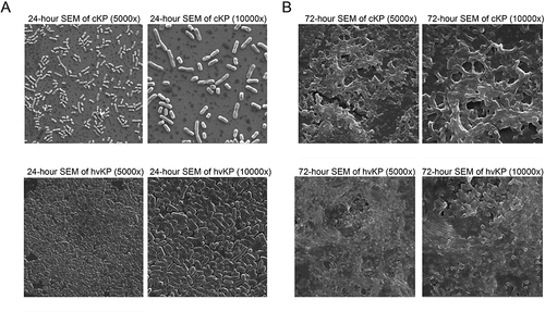 Figure 1 Scanning Electron Microscopy (SEM) Analysis of Biofilm Formation in hvKP and cKP Groups. (A) 24-Hour Biofilm Formation: This panel shows the SEM images illustrating the biofilm formation in both hypervirulent Klebsiella pneumoniae (hvKP) and classic Klebsiella pneumoniae (cKP) groups after 24 hours. The images provide a detailed view of the initial stages of biofilm development, highlighting the structural differences in the biofilm matrix between the hvKP and cKP strains. (B) 72-Hour Biofilm Formation: This panel depicts the SEM images at 72 hours, offering a comparative insight into the progression of biofilm formation in the hvKP and cKP groups. The images reveal more mature biofilm structures, showcasing the density, complexity, and architectural differences in the biofilms formed by the two groups over an extended period.