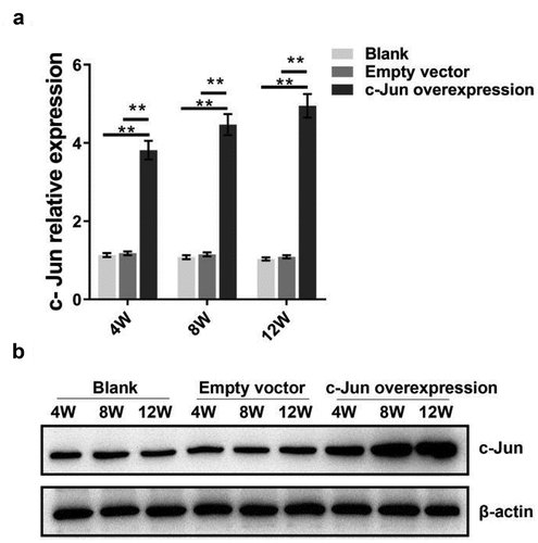 Figure 1. C-Jun expression in intervertebral disc tissue at 4, 8, and 12 weeks following the establishment of disc degeneration model. (a) The mRNA expression of c-Jun was subjected to qRT-PCR. (b) Protein levels of c-Jun were detected by western blot. Pairwise data analysis employed one-way ANOVA followed by post hoc Tukey’s test (mean ± SD, n = 5). ‘**’ p < 0.01