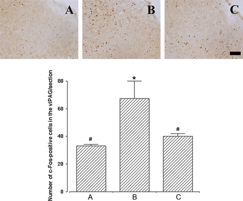 Figure 4.  Effect of human adipose-derived stem cells (ADSCs) on c-Fos expression in the ventrolateral periaqueductal gray (vlPAG). Upper panels: representative photomicrographs of c-Fos-positive cells in the vlPAG. The sections were stained for c-Fos-like immunoreactivity (brown) as described in Materials and methods. The scale bar represents 100 µm. Lower panel: the mean number±SEM of c-Fos immunoreactivity in sham-operation (A), SUI-induction (B) and SUI-induction followed by human ADSC injection (C) groups. *represents P<0.05 compared with the sham-operation group and #represents P<0.05 compared with the SUI-induction group.