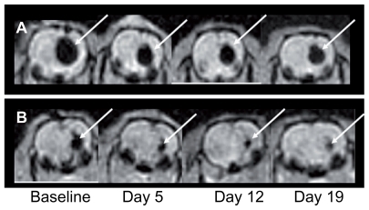 Figure 3 Gradient-echo magnetic resonance images of nanoparticle distributions as a function of time for a rat treated with γ-Fe2O3~HSA-MTX (A) and a rat treated with γ-Fe2O3 (B).