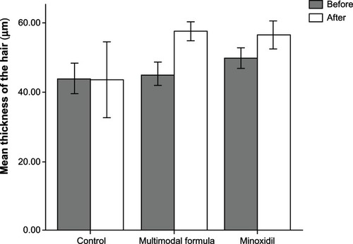 Figure 3 Comparison of mean hair thickness (μm) at baseline and after 32 weeks of treatment.