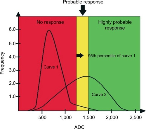 Figure 8 Illustrative diagram showing curves of hypothetical histogram analysis before treatment (Curve 1) and after treatment (Curve 2), the latter showing a partial therapeutic response.Notes: The curves are divided into three tracks: one above 1,500 µm2/s, another between 1,500 µm2/s and the 95th percentile of the baseline (pre-treatment) curve, and the third one below the 95th percentile. The range above 1,500 µm2/s is considered as a response with tissue necrosis (highly probable response to the treatment), the intermediate range as microscopic cellular necrosis (likely response), and the range below the 95th percentile as viable tumor tissue (absence of response). The red area under Curve 2 corresponds to pixels of metastatic lesions without response to the administered treatment, ie, with viable neoplastic tissue. The yellow and green areas under Curve 2 correspond to pixels of metastatic lesions with a likely and highly likely response, respectively.Abbreviation: ADC, apparent diffusion coefficient.