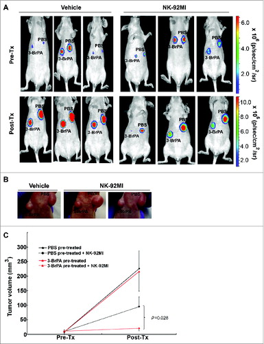 Figure 6. 3-BrPA pretreatment enhances NK-cell mediated antitumor effects in MDA-MB-231 breast cancer model. Luciferase tagged MDA-MB-231 cells pretreated with either 20 μM 3-bromopyruvate (3-BrPA) or phosphate-buffered saline (PBS) were implanted subcutaneously in female athymic nude mice and subjected to natural killer (NK) therapy as indicated. (A) Bioluminescent imaging of developing tumors showing that 3-BrPA pretreatment enhances tumor sensitivity to NK-92MI. (B) Tumor images showing reduction in tumor size in 3-BrPA pretreated MDA-MB-231 subjected to NK-92MI therapy. (C) Graph showing significant difference between PBS or 3-BrPA pretreated MDA-MB-231 tumor cells upon NK-92MI treatment.