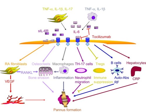 Figure 1 Functions of IL-6 in RA and blockage of IL-6 signal transduction by tocilizumab.