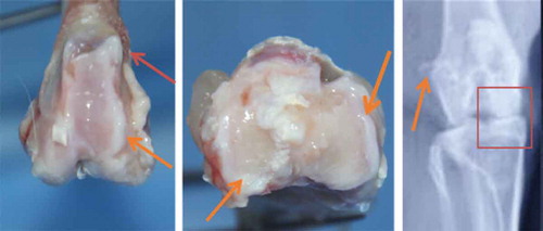 Figure 3. Macroscopic and radiological appearance of osteophytes and degenerative alterations