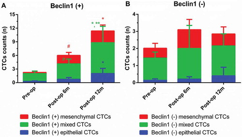 Figure 8. Dynamic changes of Beclin1 expression in CTCs in metastatic group. (Data were presented as mean ± SD and P < 0.05 was considered statistically significant. Pre-op: preoperatively, post-op 6m: 6 months postoperatively, post-op 12m: 12 months postoperatively. * P < 0.05 Post-op 12m vs. Pre-op; ** P < 0.05 Post-op 12m vs. Post-op 6m; # P < 0.05 Post-op 6m vs. Pre-op.).