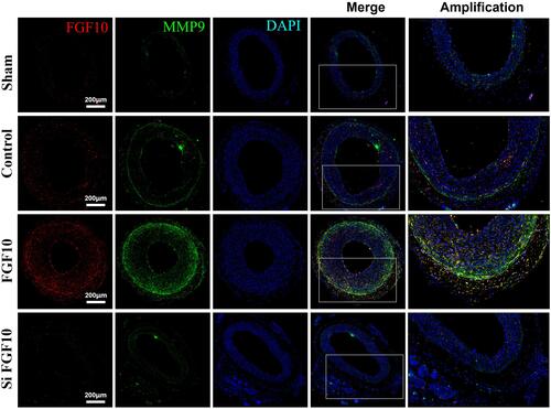 Figure 8 MMP9 expressions were upregulated by FGF10 in vivo. The balloon injuries were performed in rat LCA with or without deliveries of exogenous FGF10 or siFGF10-2 and the whole LCA were harvested on day 14 post the procedure for staining of FGF10, MMP9 and DAPI. Bar=200μm, n=5.