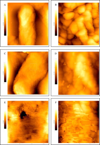 Figure 5.  AFM images of the native E. coli XL1 Blue cell in phosphate buffer (images A & B), after generation of competence in 100 M CaCl2 at 0°C (images C & D), after heat pulse at 42°C for 90 s (image E) and after cold shock at 0°C for 5 min (image F). The scanning area of the images A and C of entire bacteria were 2×2 µm2. Two dimensional images B, D, E and F were acquired by zooming into the boxed area (0.7×0.7 µm2) of the images A and C. In every case 15 individual cells were studied. This Figure is reproduced in colour in Molecular Membrane Biology online.