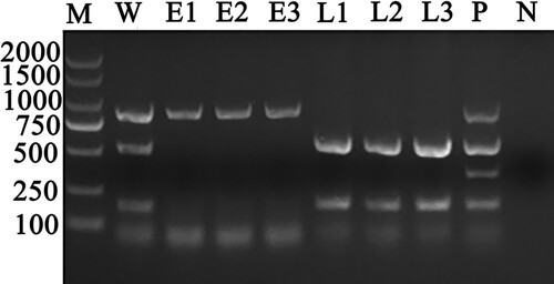 Figure 1. Results of multiplex PCR detection assay for the identification of A. capra sp. nov in whole blood, erythrocyte, and leukocyte DNA samples from the same goat whole blood sample. Lane W: Whole blood DNA sample positive for A. capra sp. nov (874 bp), A. bovis (529 bp), and A. phagocytophilum (172 bp). Lanes E1–E3: Erythrocytes DNA samples positive for A. capra sp. nov (874 bp). Lanes L1–L3: Leukocytes DNA samples positive for A. bovis (529 bp) and A. phagocytophilum (172 bp). Lane P: Positive control of multiplex PCR for detecting A. capra sp. nov, A. bovis, A. ovis (347 bp), and A. phagocytophilum. Lane N: Negative control.
