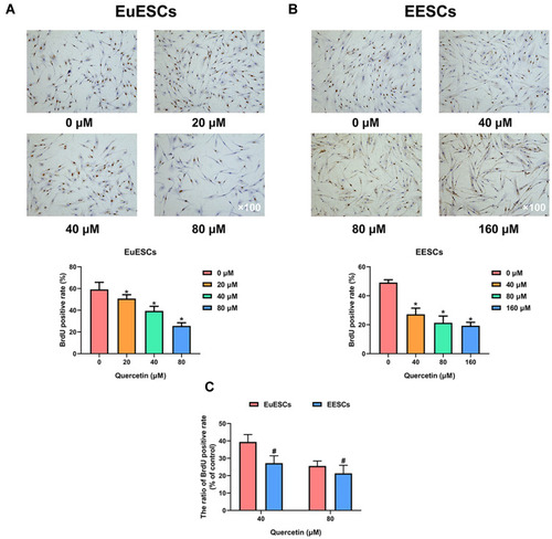 Figure 3 Quercetin inhibits the proliferation of EuESCs and EESCs in vitro. (A) Representative images for BrdU assay on EuESCs under a microscopy (Magnification ×100) after treatment with increasing concentrations of quercetin (0, 20, 40, and 80 μM) for 72 h. The bar graphs represented the BrdU positive rate of EuESCs. (B) Representative images for BrdU assay on EESCs under a microscopy (Magnification ×100) after treatment with increasing concentrations of quercetin (0, 40, 80, and 160 μM) for 72 h. The bar graphs represented the BrdU positive rate of EESCs. (C) The bar graph represented the ratio of BrdU positive rate between quercetin treatment group (40 or 80 μM) and control group (0 μM). Data were presented as mean ± SD; *P <0.05 vs 0 μM group; #P <0.05 vs EuESCs group. Each experiment was performed three times.