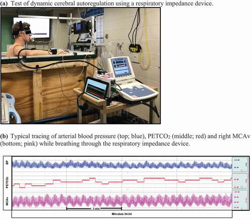 Figure 1. (a)Test of dynamic cerebral autoregulation using a respiratory impedance device. (b) Typical tracing of arterial blood pressure (top; blue), PETCO2 (middle; red) and right MCAv (bottom; pink) while breathing through the respiratory impedance device. (c) Test of cerebrovascular reactivity using a stepped hypercapnia protocol. (d) Typical tracing of the PETCO2 waveform (top; blue) and right MCAv (bottom; pink) at baseline breathing room air and throughout the stepped hypercapnia protocol