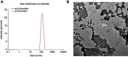 Figure S1 (A) DLS analysis of C-TN-APNPs with and without treatment of thrombin. (B) Representative TEM images of C-TN-APNPs after thrombin treatment (scale bar, 50 nm).