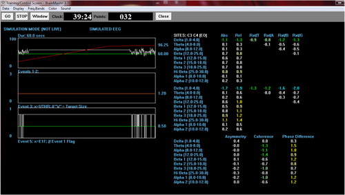 Fig. 2. Screen-shot of the target value summary in LZS training protocol.Abs, absolute power; Rel, relative power; Rat/T, ratio to theta value; Rat/A, ratio to alpha value; Rat/B, ratio to beta value; Rat/G, ratio to gamma value.