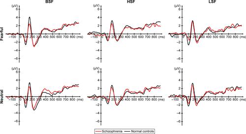 Figure S2 Averaged N250 waves from both hemispheres at F1/FC1/FC3 and F2/FC2/FC4 electrodes in patients with schizophrenia and healthy controls.Abbreviations: BSF, broad spatial frequency; HSF, high spatial frequency; LSF, low spatial frequency.