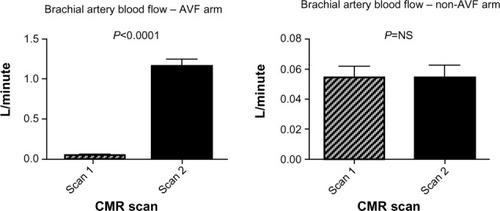 Figure 4 Alteration in CMR-assessed brachial artery blood-flow, ipsilateral and contralateral to the newly created arteriovenous fistula.