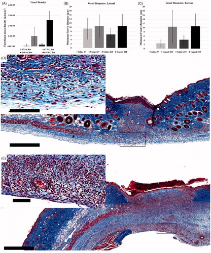 Figure 4. Quantification and corresponding representative micrographs of control (saline) and Capgel™-treated wound microvasculature. (A) Comparison of vessel density between control and Capgel™-treated wounds; minimum Feret’s diameter analysis of lateral (B) and (C) bottom wound ROIs. Micrographs of Trichrome staining from d10 mice: (D) control, (E) Capgel™. Capgel™-treated wounds (E) had more microvessels present than saline controls. Scale bars = 500 µm (full image), 100 µm (inset). Sal = Saline.