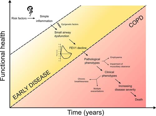 Figure 3 Hypothetical timeline of disease progression in susceptible smokers. Subjects who are persistently exposed to risk factors (eg, cigarette smoke, air pollutants, biomass fuel smoke) suffer from low-grade airway inflammation. However, a subset of them (which may be genetically determined or dependent on epigenetic factors) are predisposed to develop COPD in later life over many years. These subjects may initially develop small airway dysfunction and if highly active, will have rapid lung function decline until they cross the diagnostic threshold for COPD. Many COPD patients are diagnosed only when they suffer from established symptoms and impaired health. At this point, the complexities of the pathological and clinical phenotypes are already established and damage is irreversible which increases the challenge of developing disease-modifying therapies for clinical trials. The most logical approach is to identify disease earlier when the pathological inflammation is only influenced by risk factors and gene/environment susceptibility (white to yellow zone) and not by amplification due to tissue damage and progression to variable phenotypes and their combinations (red zone).