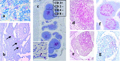 FIG. 2. (a) liver, gd 40, immunoreactive for CD117, indicative for HSC; (b) horizontal section through the cisterna chyli area with lymphatic parenchymia, focally reacting with HLA-DR antibody (arrows); (c) thymus on gd60 stained with HLA-DR antibody; there is a clear stain of the medullary area; the thymus is immunopositive for CD3 and immuno-negative for CD2, CD4, and CD8; inset: mesenchymal cells close to the thymus at day 50; (d) thymus on gd70 with medullary localized CD3 immunopositive cells (T-cells?); (e) thymus on gd70 with medullary localized HLA-DR immunopositive cells, corresponding to CD3+ distribution; (f) lymph node primordium on gd70 with an area of CD3 immuno-positive cells (T-cells?); (g) lymph node primordium on gd70 with few HLA-DR immunopositive cells.